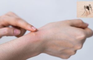 No dejes que te pique el mosquito: IMSS pide reforzar medidas de prevención contra el dengue en México