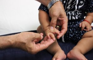 Tienen mayor bienestar las y los sudcalifornianos atendidos con cirugías de manos y pies