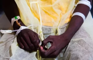 Mueren 172 por cólera en Sudán en sólo una semana; crisis empeora