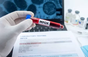 Mpox cobra vida en Quintana Roo: alerta en estos estados