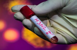 Secretaría de Salud confirma primer caso de influenza A H3N2, “supergripe” llega a México