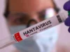 Salud emite aviso epidemiológico por brote de hantavirus; síntomas iniciales son parecidos a la gripe