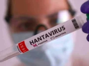 Salud emite aviso epidemiológico por brote de hantavirus; síntomas iniciales son parecidos a la gripe