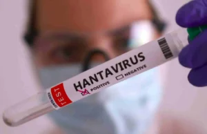 Salud emite aviso epidemiológico por brote de hantavirus; síntomas iniciales son parecidos a la gripe