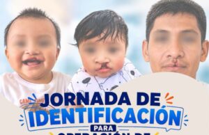 Invita DIF Los Cabos a Jornada de Identificación para Operación de Labio Leporino y Paladar Hendido