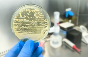 UNAM alerta: bacteria resistente a antibióticos está presente en animales, plantas y alimentos