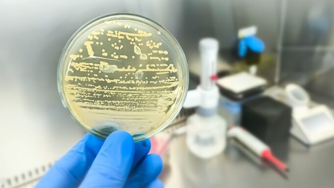 bacteria-104457