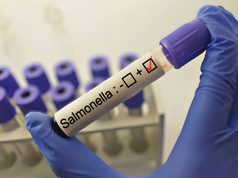 Salud confirma brote de salmonela en Hospital General de México; hay 135 afectados
