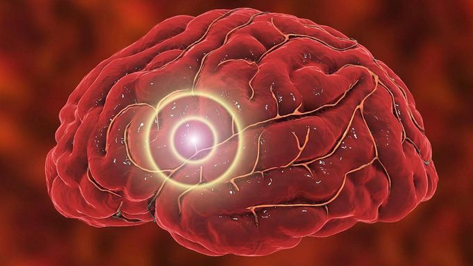 cerebro-181135